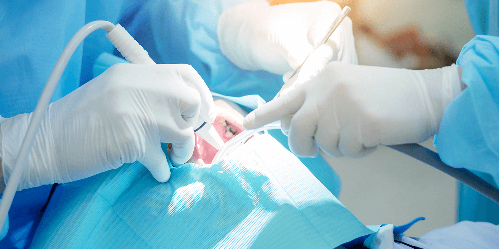 歯牙移植手術の成功のポイント